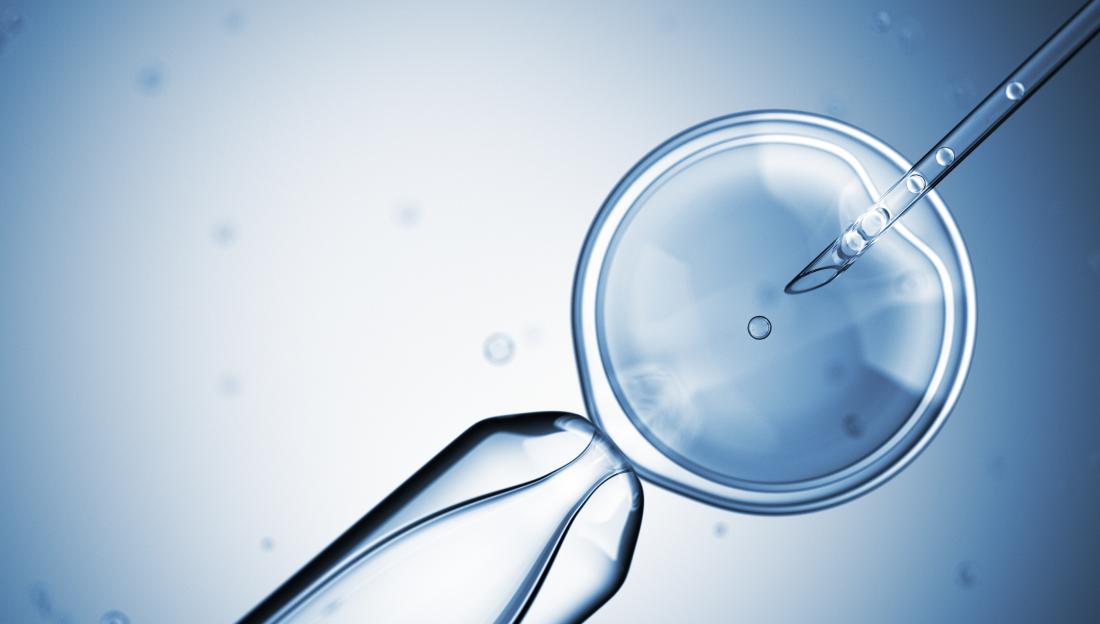 In Vitro Fertilization Cost an Treatment